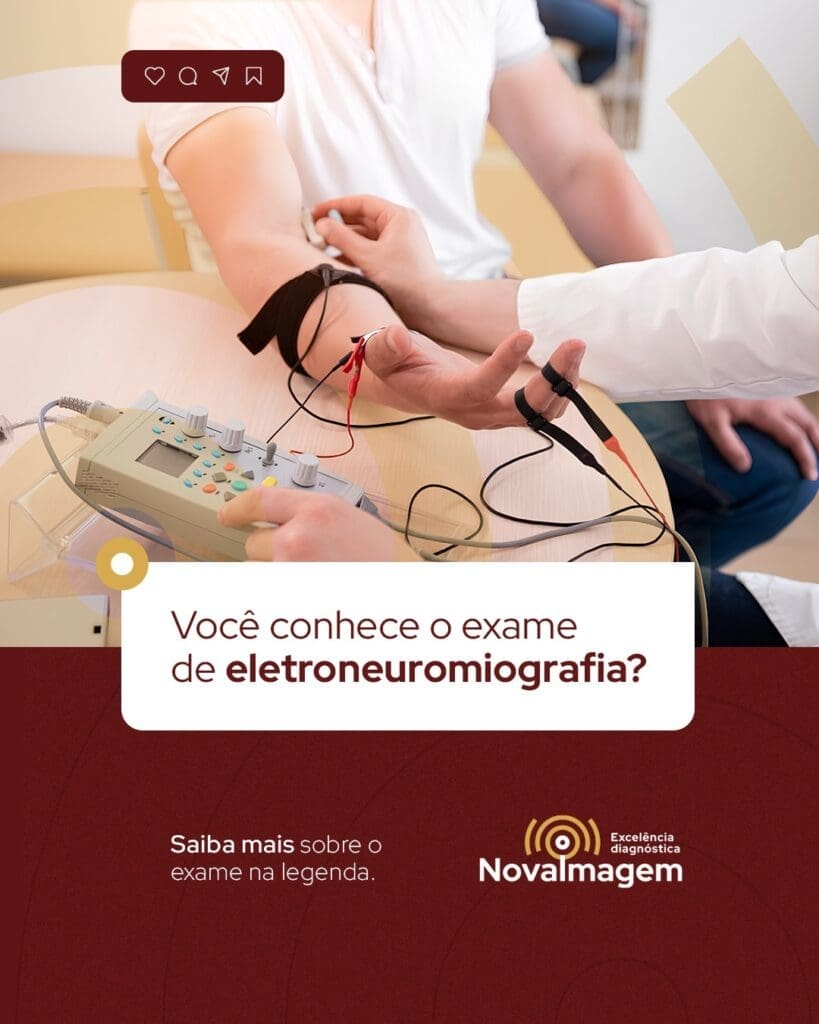Sente dormência, formigamento ou fraqueza muscular? Esses sintomas podem parecer simples no início, mas muitas vezes indicam alterações nos nervos ou nos músculos que precisam ser investigadas com mais atenção. Sente dormência, formigamento ou fraqueza muscular? Esses sintomas podem parecer simples no início, mas muitas vezes indicam alterações nos nervos ou nos músculos que precisam ser investigadas com mais atenção.